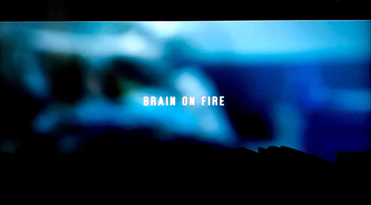 彼女が目覚めるその日まで Brain on Fire